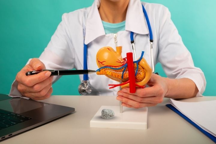 Can pancreatic stones be treated without surgery Gastro Hospital in Gurgaon